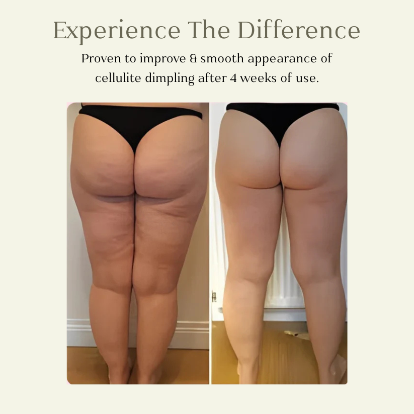 Luuma Pro Cellulite Roller