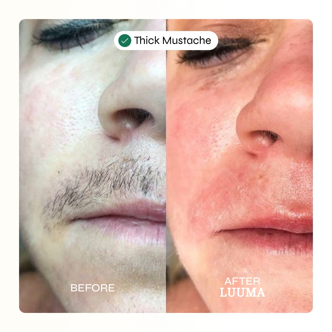 Facial Hair Removal Cream