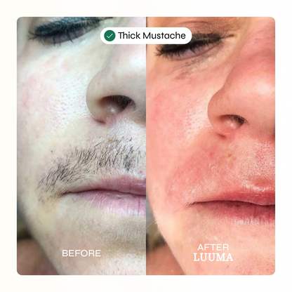 Facial Hair Removal Cream