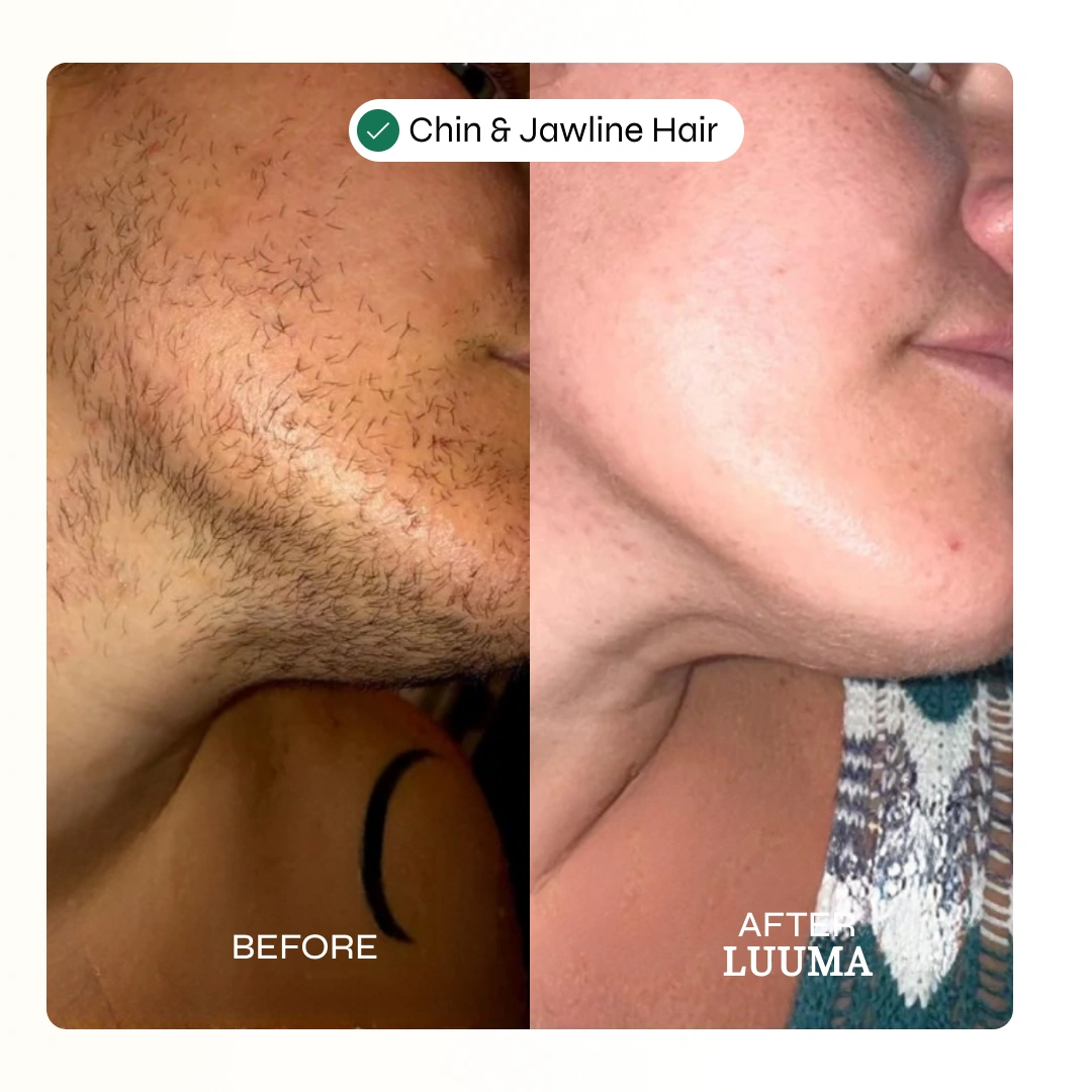 Facial Hair Removal Cream