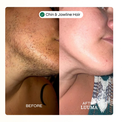 Facial Hair Removal Cream