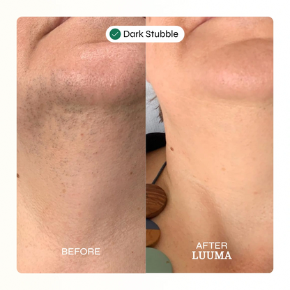 Facial Hair Removal Cream