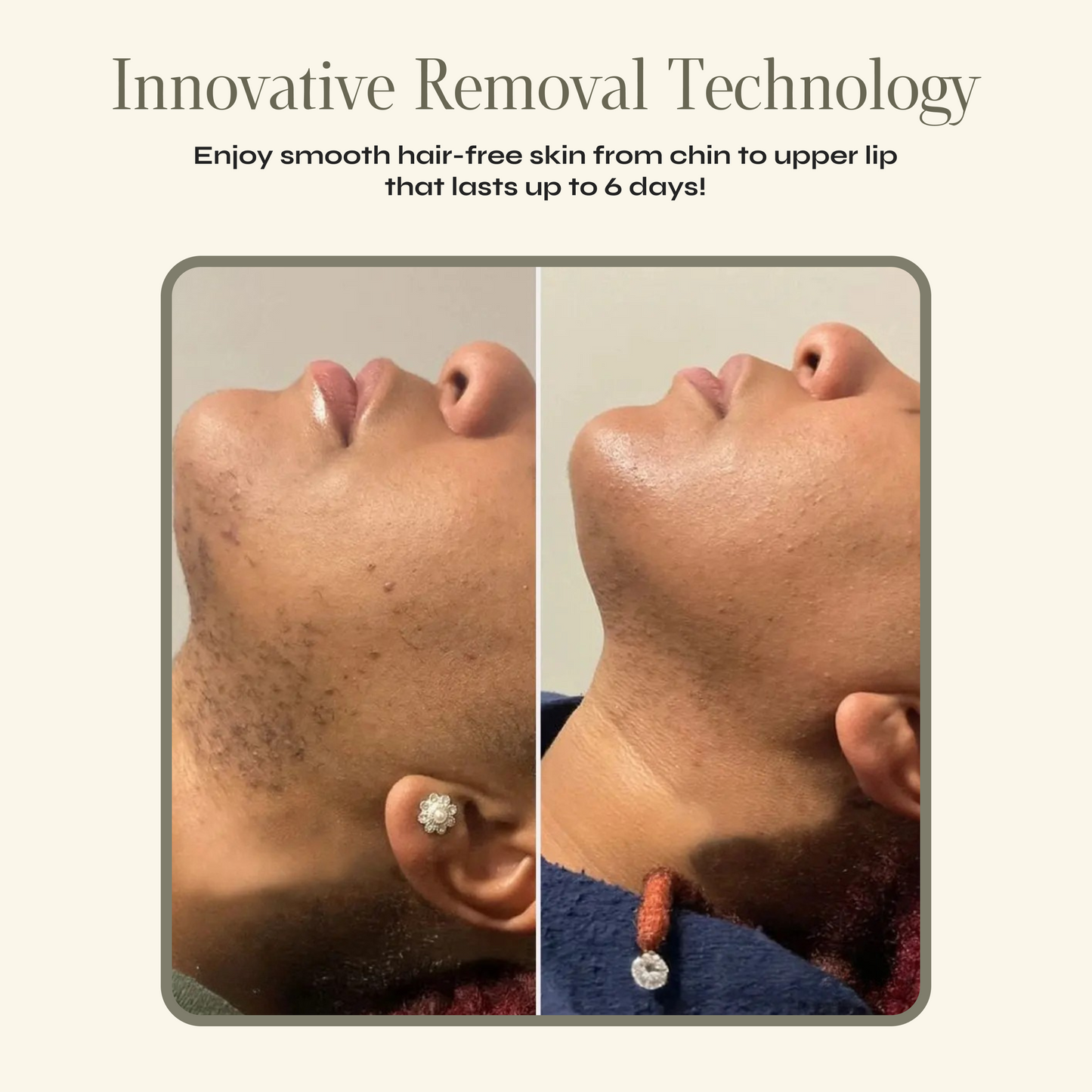 Painless Hair Removal Cream